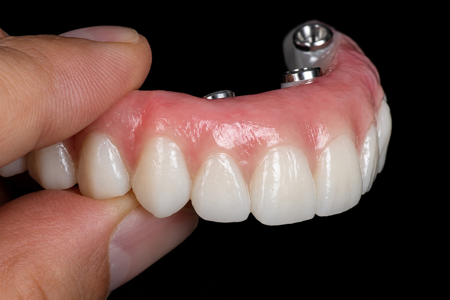 Ti-bar with Aesthetic Zirconia